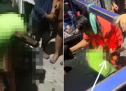 Ternyata Bukan Besi Plat, Insiden Kebakaran di Makassar Bokong Remaja Tertusuk Balok Kayu