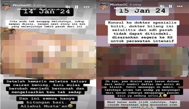 Tangkapan Layar unggahan instagram korban malapraktik