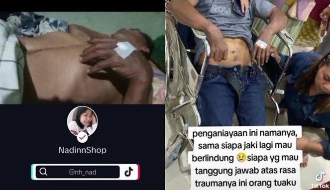 Viral, Pria di Gowa Diduga Dianiaya Oknum Polisi saat Jadi Saksi