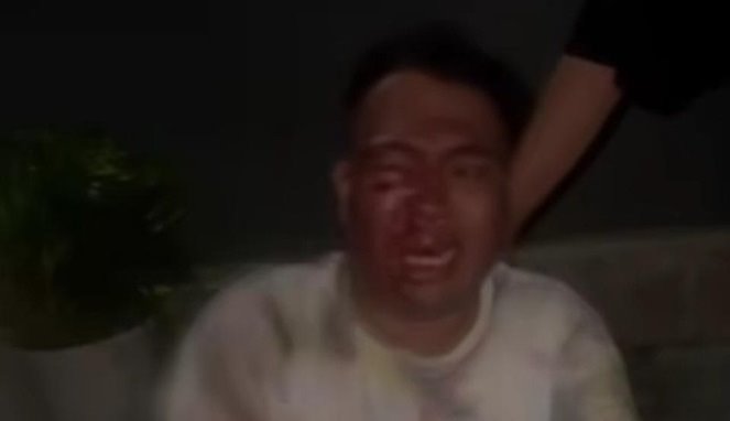 Tangkapan Layar,Empat Oknum Polisi di Bitung Diduga Aniaya Warga