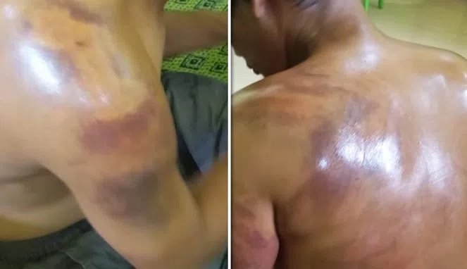 Wendi Disiksa di Polsek Tanpa Alasan yang Jelas