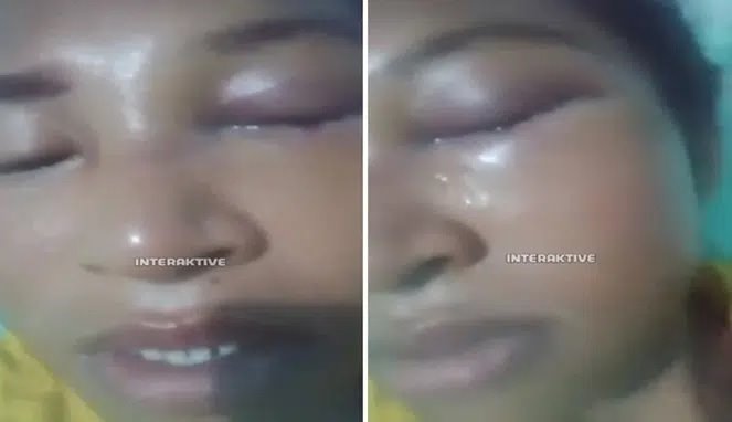 KDRT Mengerikan di Rokan Hulu: Suami Hancurkan Wajah Istri