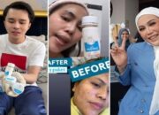 Ulasan Pedas dr. Oky: Skincare Zam-zam Whitening Cream Bahayakan Kulit!