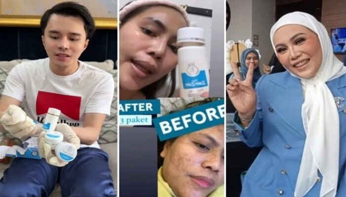 Ulasan Pedas dr. Oky: Skincare Zam-zam Whitening Cream Bahayakan Kulit!
