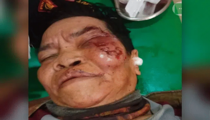Geger, Anak Tuna Wicara Hamil 8 Bulan di Gowa Ayah Ditangkap Polisi