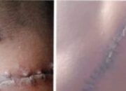 Enam Nama Disebut, Satu Dijerat, Penanganan Kasus Berdarah Dipertanyakan