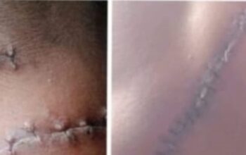 Enam Nama Disebut, Satu Dijerat, Penanganan Kasus Berdarah Dipertanyakan