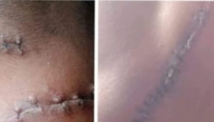 Enam Nama Disebut, Satu Dijerat, Penanganan Kasus Berdarah Dipertanyakan