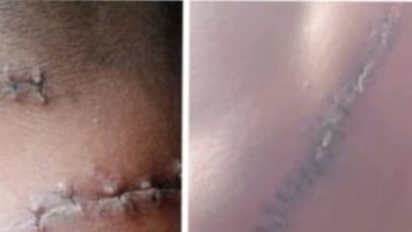 nam Nama Disebut, Satu Dijerat, Penanganan Kasus Berdarah Dipertanyakan