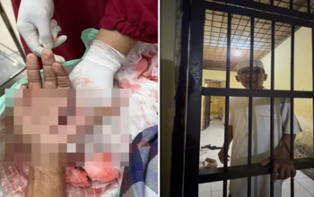 Miris! Tokoh Penentang Prostitusi di Jeneponto Malah Dibui Meski Tangan Nyaris Putus