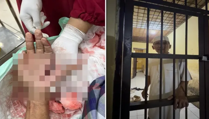 Miris! Tokoh Penentang Prostitusi di Jeneponto Malah Dibui Meski Tangan Nyaris Putus