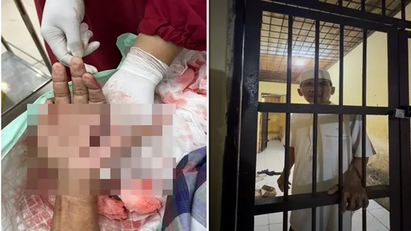 Miris! Tokoh Penentang Prostitusi di Jeneponto Malah Dibui Meski Tangan Nyaris Putus