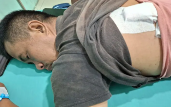 Pelaku Pembacokan Pedagang Percut Sei Tuan Ingkar Janji, Polisi Diminta Bertindak